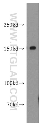 DHX29 Antibody in Western Blot (WB)