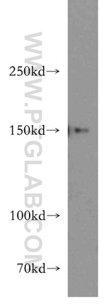 DHX29 Antibody in Western Blot (WB)