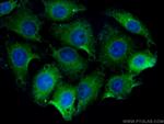 DCX Antibody in Immunocytochemistry (ICC/IF)