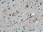 NPC1 Antibody in Immunohistochemistry (Paraffin) (IHC (P))