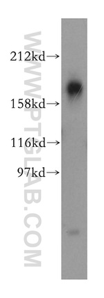 NPC1 Antibody in Western Blot (WB)