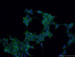 GNAQ Antibody in Immunocytochemistry (ICC/IF)