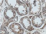 GNAQ Antibody in Immunohistochemistry (Paraffin) (IHC (P))