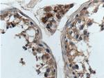 GNAQ Antibody in Immunohistochemistry (Paraffin) (IHC (P))