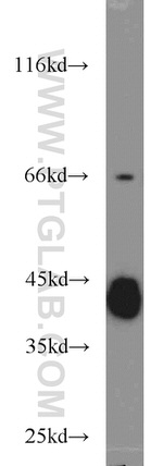 GNAQ Antibody in Western Blot (WB)