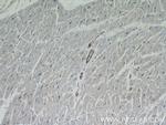 Calponin 1 Antibody in Immunohistochemistry (Paraffin) (IHC (P))