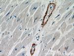 Calponin 1 Antibody in Immunohistochemistry (Paraffin) (IHC (P))