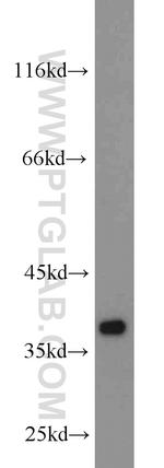 Calponin 1 Antibody in Western Blot (WB)