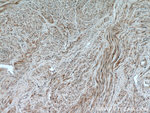 Calponin 1 Antibody in Immunohistochemistry (Paraffin) (IHC (P))