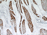 Calponin 1 Antibody in Immunohistochemistry (Paraffin) (IHC (P))