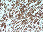 Calponin 1 Antibody in Immunohistochemistry (Paraffin) (IHC (P))