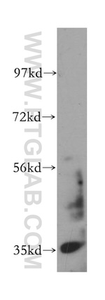 Calponin 1 Antibody in Western Blot (WB)