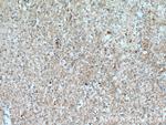 PGM2L1 Antibody in Immunohistochemistry (Paraffin) (IHC (P))