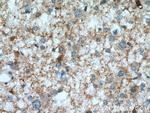 PGM2L1 Antibody in Immunohistochemistry (Paraffin) (IHC (P))