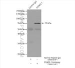 PGM2L1 Antibody in Immunoprecipitation (IP)