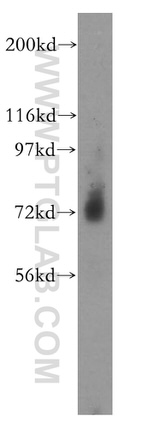 PGM2L1 Antibody in Western Blot (WB)