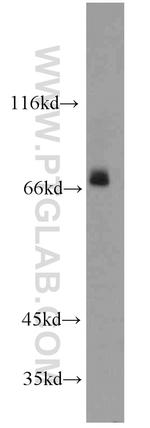 PGM2L1 Antibody in Western Blot (WB)