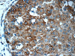 MAPKAPK2 Antibody in Immunohistochemistry (Paraffin) (IHC (P))