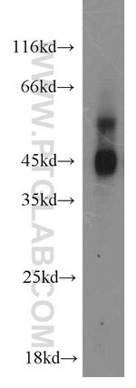 MAPKAPK2 Antibody in Western Blot (WB)