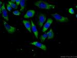 ABCF1 Antibody in Immunocytochemistry (ICC/IF)