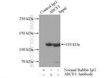 ABCF1 Antibody in Immunoprecipitation (IP)