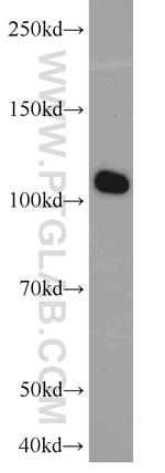 ABCF1 Antibody in Western Blot (WB)