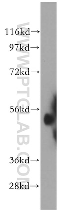 ALDH1A2 Antibody in Western Blot (WB)