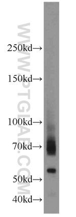 ADAM2 Antibody in Western Blot (WB)