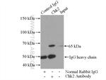Chk2 Antibody in Immunoprecipitation (IP)