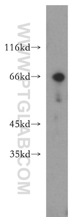 Chk2 Antibody in Western Blot (WB)