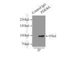 PDE8A Antibody in Immunoprecipitation (IP)