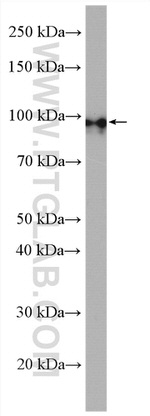 PDE8A Antibody in Western Blot (WB)