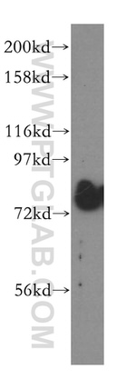 GALNT7 Antibody in Western Blot (WB)