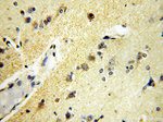 MICAL2 Antibody in Immunohistochemistry (Paraffin) (IHC (P))