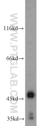 DDI1 Antibody in Western Blot (WB)