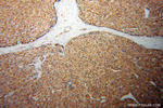 CTNNA3 Antibody in Immunohistochemistry (Paraffin) (IHC (P))