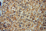 CTNNA3 Antibody in Immunohistochemistry (Paraffin) (IHC (P))