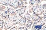 CTNNA3 Antibody in Immunohistochemistry (Paraffin) (IHC (P))