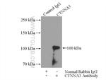 CTNNA3 Antibody in Immunoprecipitation (IP)