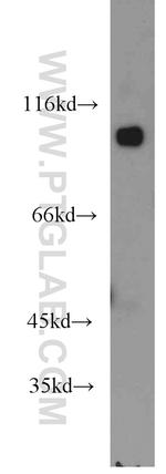 CTNNA3 Antibody in Western Blot (WB)