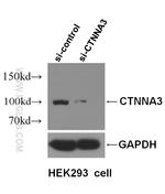 CTNNA3 Antibody in Western Blot (WB)