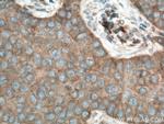 YES1 Antibody in Immunohistochemistry (Paraffin) (IHC (P))