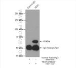 YES1 Antibody in Immunoprecipitation (IP)