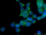 SEC63 Antibody in Immunocytochemistry (ICC/IF)