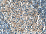 SEC63 Antibody in Immunohistochemistry (Paraffin) (IHC (P))