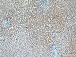 SEC63 Antibody in Immunohistochemistry (Paraffin) (IHC (P))