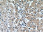 SEC63 Antibody in Immunohistochemistry (Paraffin) (IHC (P))