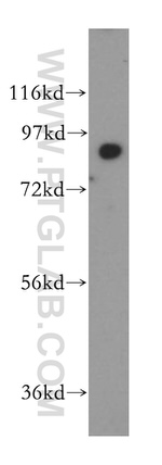 SEC63 Antibody in Western Blot (WB)
