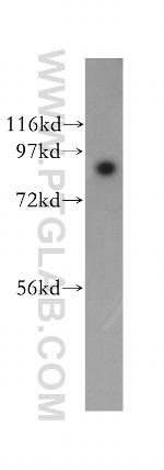 SEC63 Antibody in Western Blot (WB)