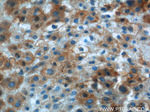 IGFBP1 Antibody in Immunohistochemistry (Paraffin) (IHC (P))